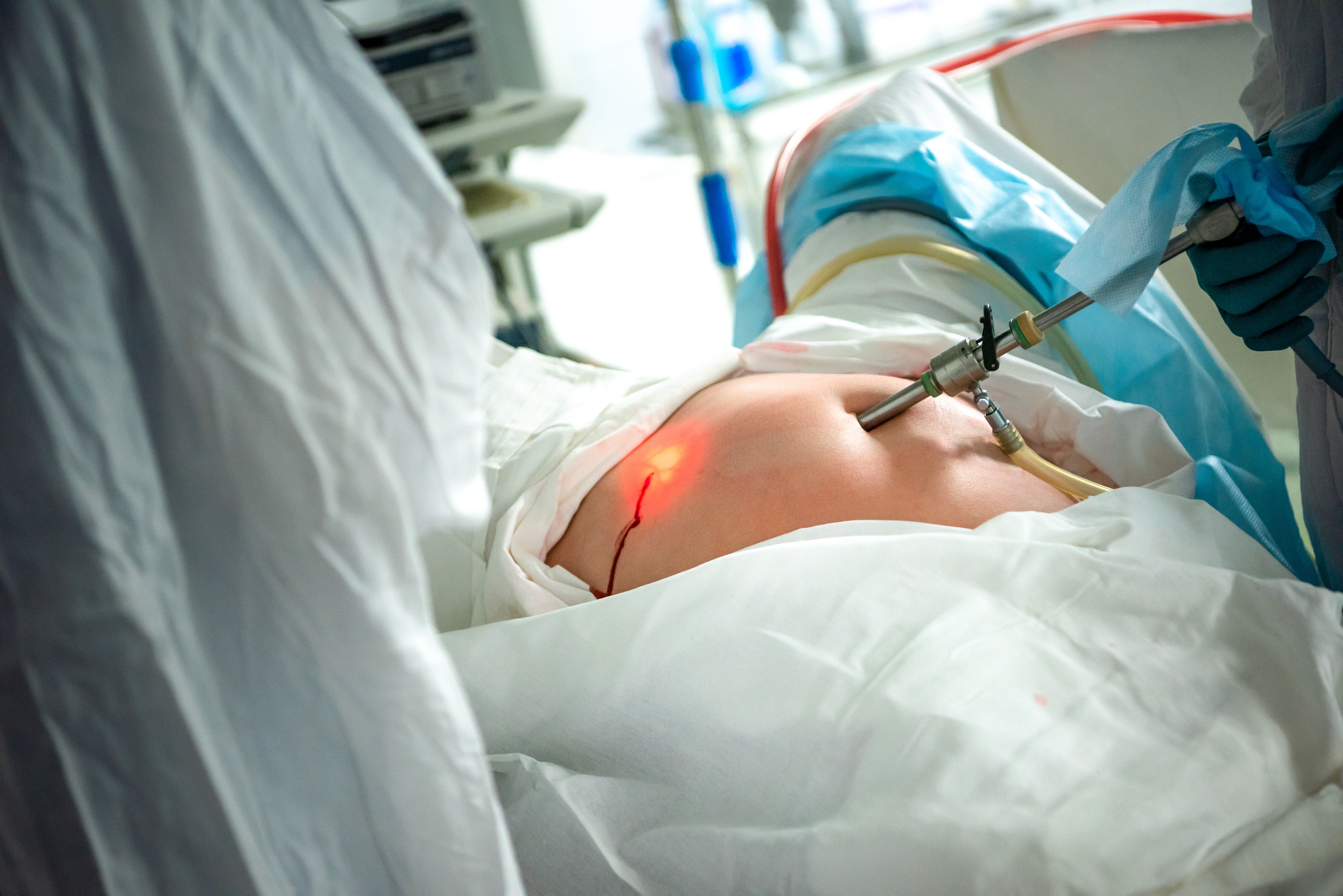 Врачи Больницы на Кутузова спасли беременную пациентку с разрывом мочевого пузыря 
