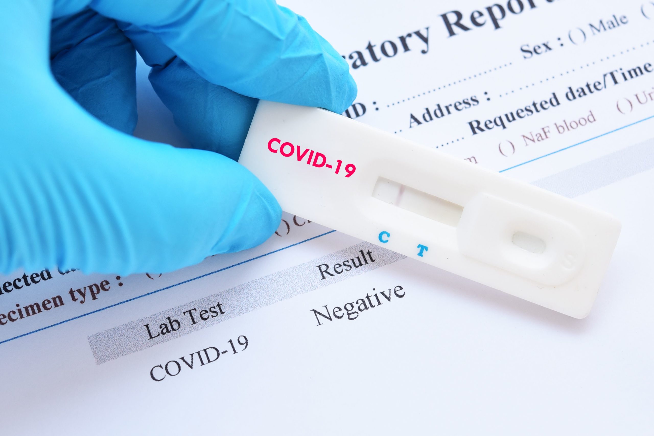 О тестировании на новую коронавирусную инфекцию в рамках ОМС
